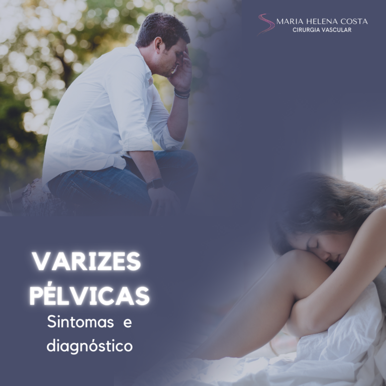 Varizes pelvicas