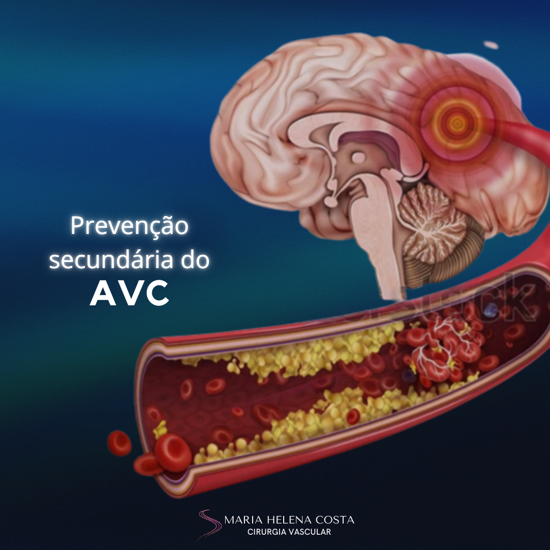 avc prevenção