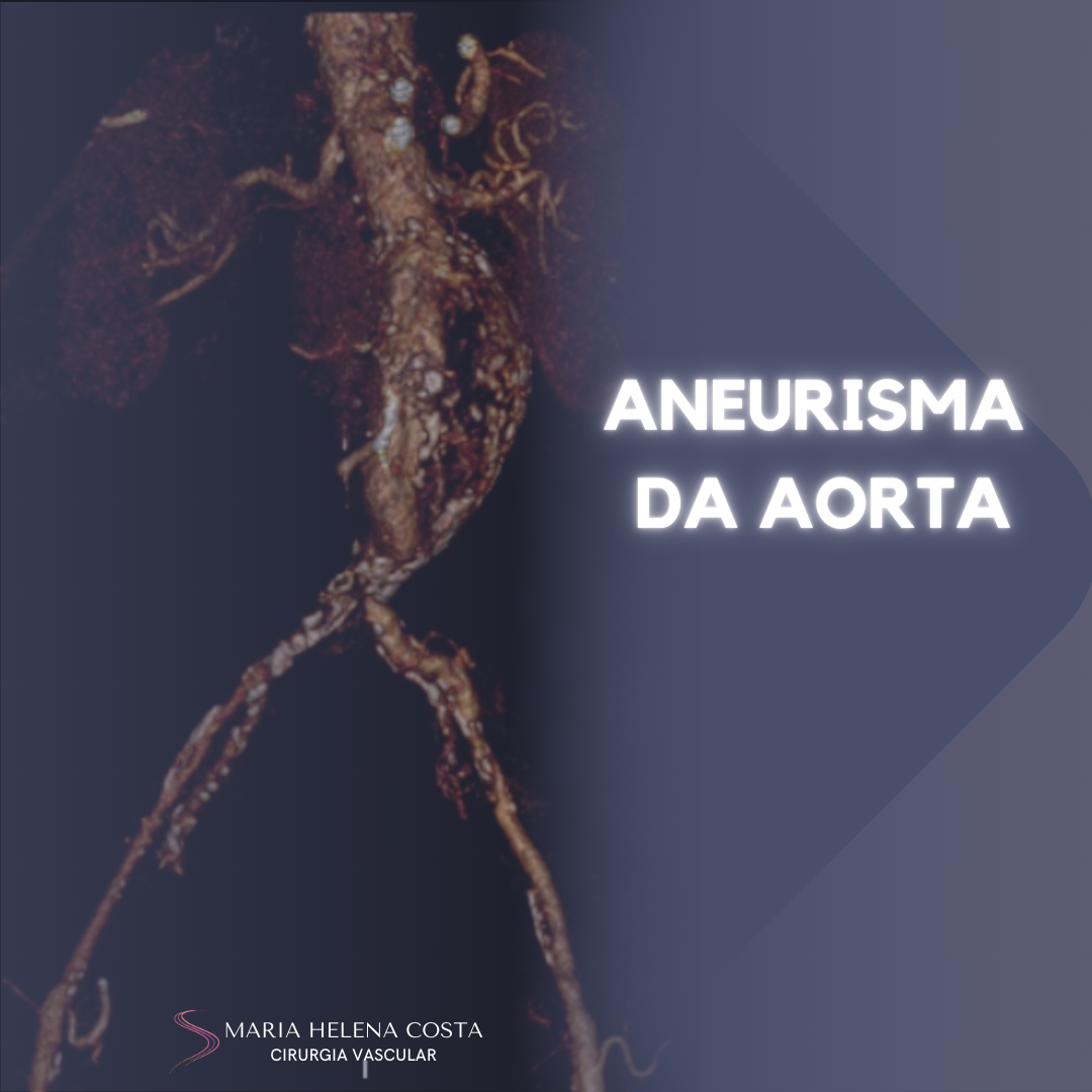 Aneurisma da aorta